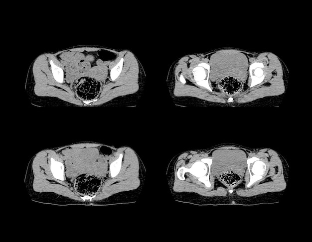 Ct Scan and MRI Abdomen professional images