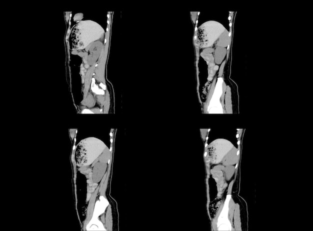 Ct Scan and MRI Abdomen professional images