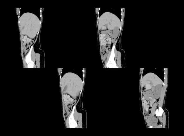 Ct Scan and MRI Abdomen professional images