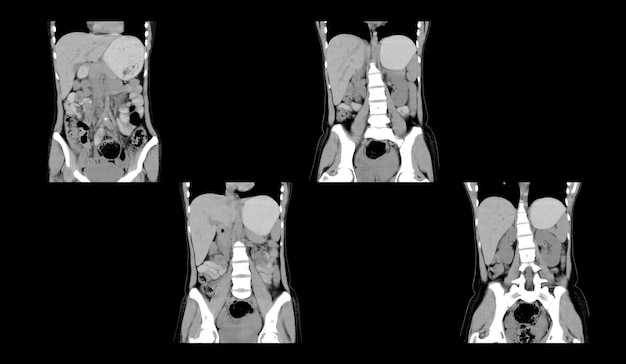 Ct Scan and MRI Abdomen professional images