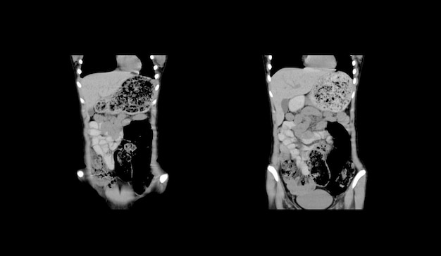 Ct Scan and MRI Abdomen professional images