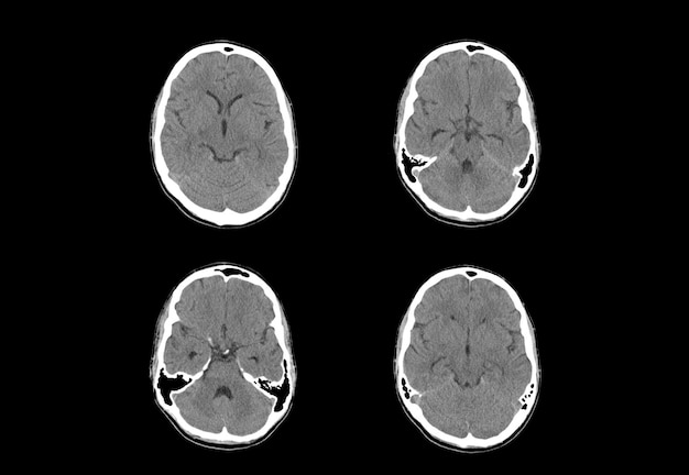 CT scan and MRI brain unique and professional images