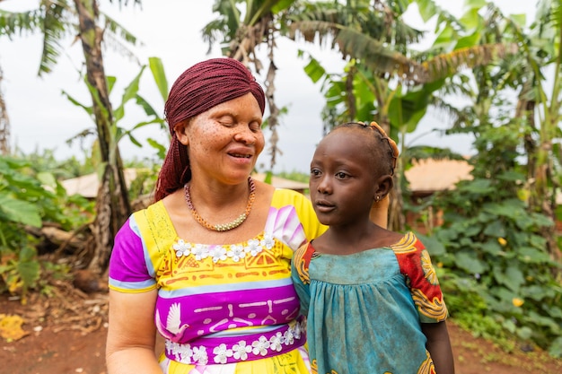 Cute little African girl enjoys being alone with her albino mom and chatting with her