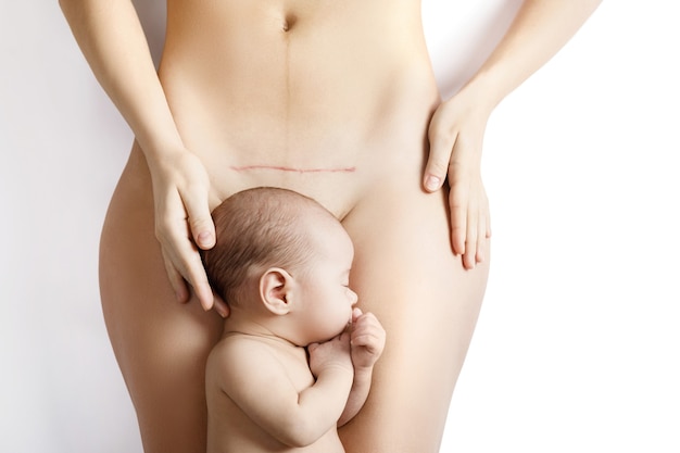 Cute little newborn baby and his mother with a scar after C-Section on her belly