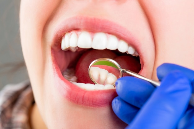 Dental care, taking care of teeth. Girl having teeth examined at dentists. Woman in stomatology clinic with dentist. Healthy teeth concept. Taking care of teeth. Woman at the dentist.