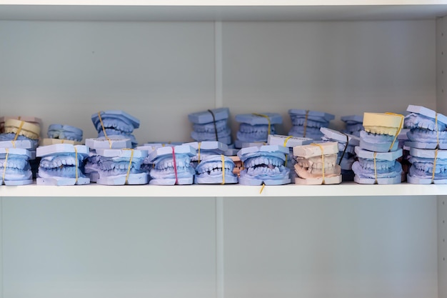 Dental gypsum models cast of a human dental jaw Gypsum models lie on a shelf in a row prosthetics