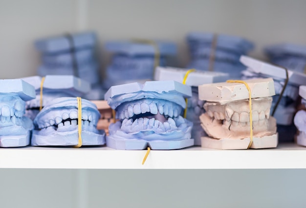 Dental gypsum models cast of a human dental jaw Gypsum models lie on a shelf in a row