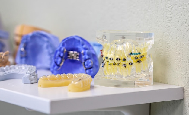 Dental gypsum models cast of a human dental jaw Gypsum models lie on a shelf in a row