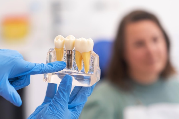 Dental implants dentist discussing a treatment plan with patient holds a dental implant model