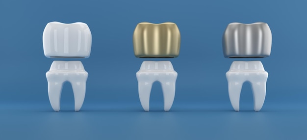 Dental implants surgery 3d rendering