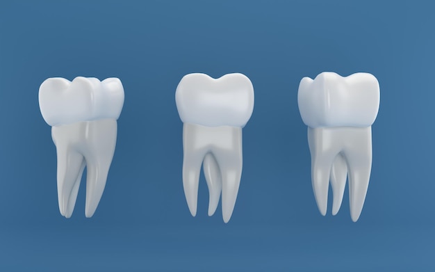 Dental implants surgery 3d rendering