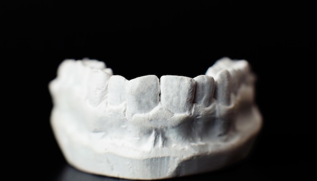 Dental jaw model over black background Dentist dental prosthetic teeth gums roots closeup