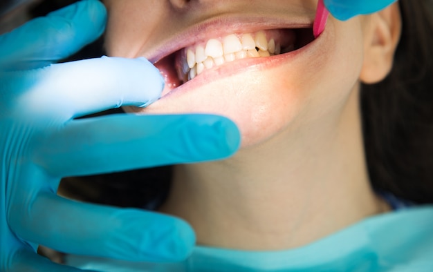 Dentist checks patient's teeth