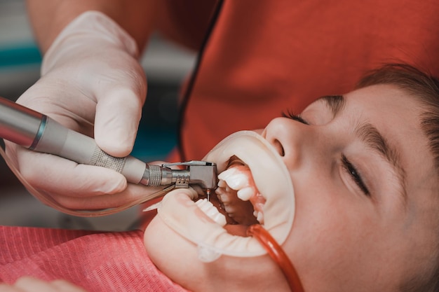 Dentist cleans tooth decay in a child with a drill in the child's mouth ejector saliva