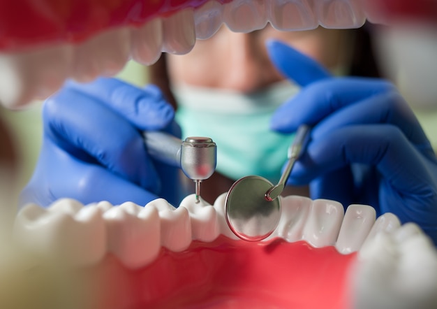 Dentist drilling teeth. View from the inside of mouth