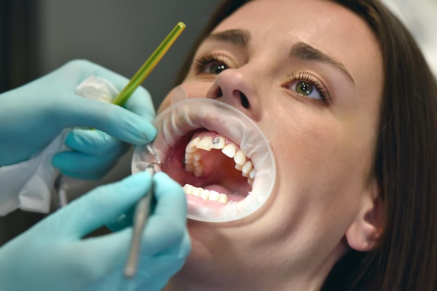 Dentist Examine Patient