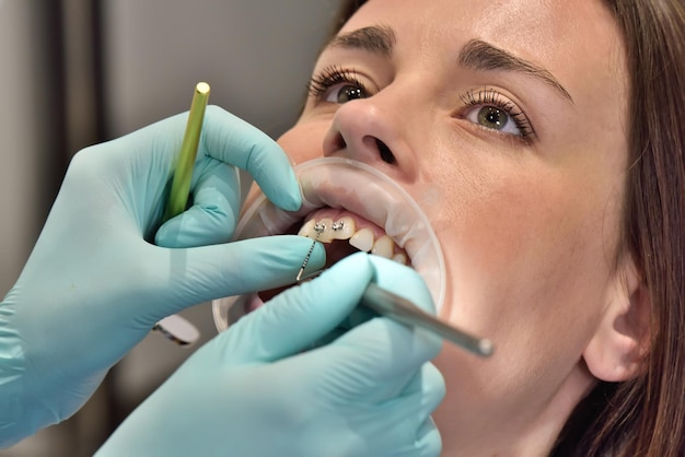 Dentist Examines Teeth With Braces