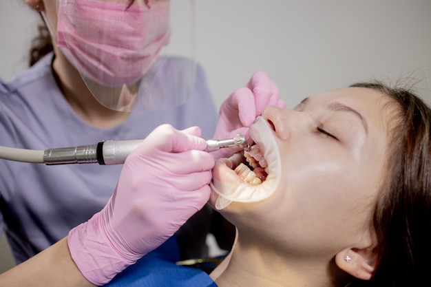 Dentist making professional teeth cleaning female young patient at the dental office. Close-up plan.