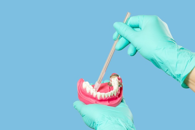 Dentist's hands in gloves with saliva ejector and human jaw layout