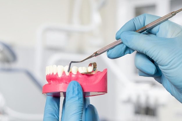 Dentist's hands with layout of the human jaw and curette