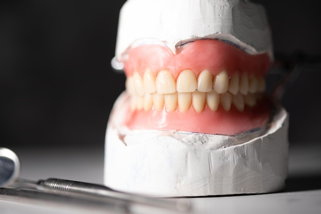 Dentist teeth and gums model