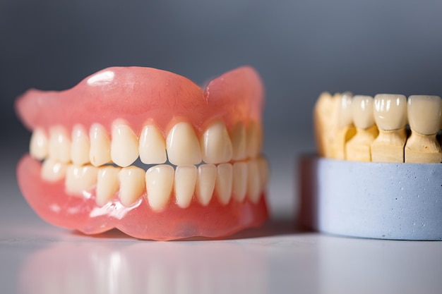 Dentist teeth and gums model