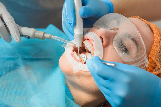 Dentist ultrasound removes stones on the teeth of a woman with a dental pad on her mouth.