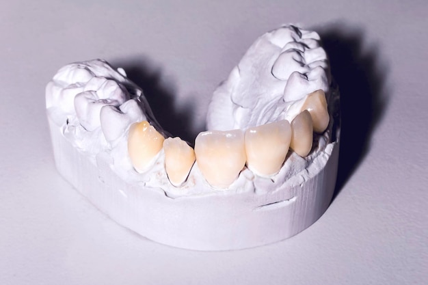 Denture close up