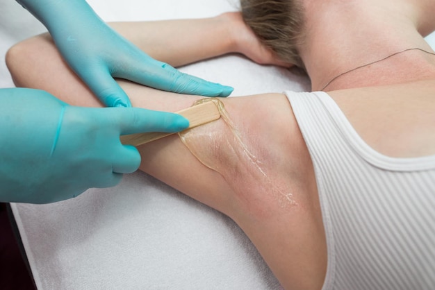 Depilation and epilation of the female armpit with liquid sugar paste The beautician's hand applies wax paste to the armpit The concept of smooth armpits