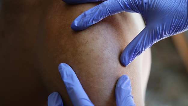 Photo dermatologist checking skin pigmentation of patient skin in hospital doctor examining male