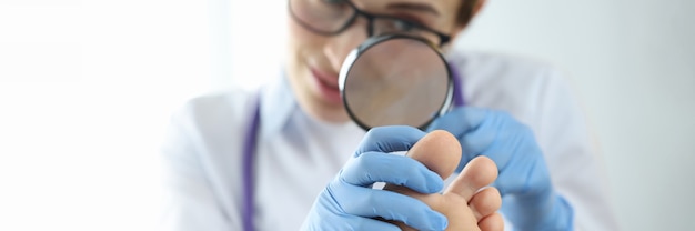 Dermatologist examining toenail with magnifying glass closeup diagnosis and treatment of fungal