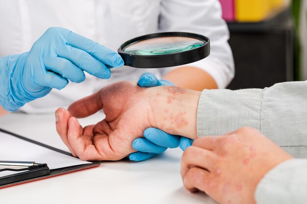 Photo a dermatologist wearing gloves examines the skin of a sick patient examination and diagnosis of skin diseasesallergies psoriasis eczema dermatitis