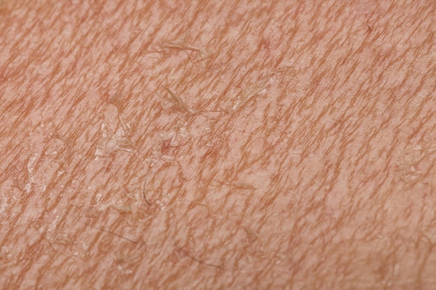 Detail of dry human skin Dehydration due to the sun's rays without sun protection