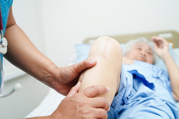 Doctor checking Asian elderly woman patient with scar knee replacement surgery in hospital