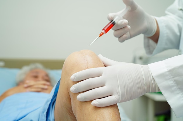 Doctor checking Asian elderly woman patient with scar knee replacement surgery in hospital