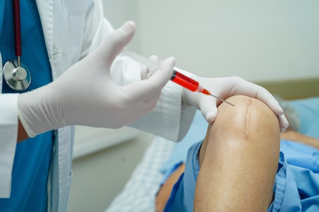 Doctor checking Asian elderly woman patient with scar knee replacement surgery in hospital