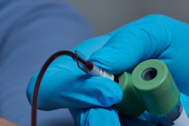 The doctor collects blood in a syringe Nurse takes blood from the veins on the arm