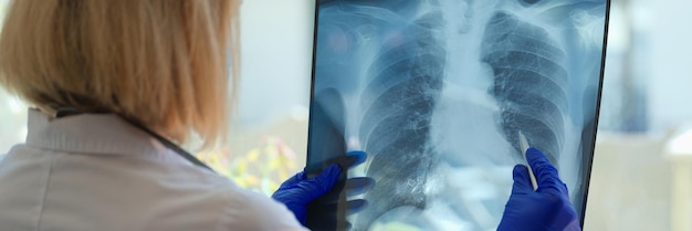 Doctor diagnoses health status of patient with asthma lung diseases and covid chest xray film