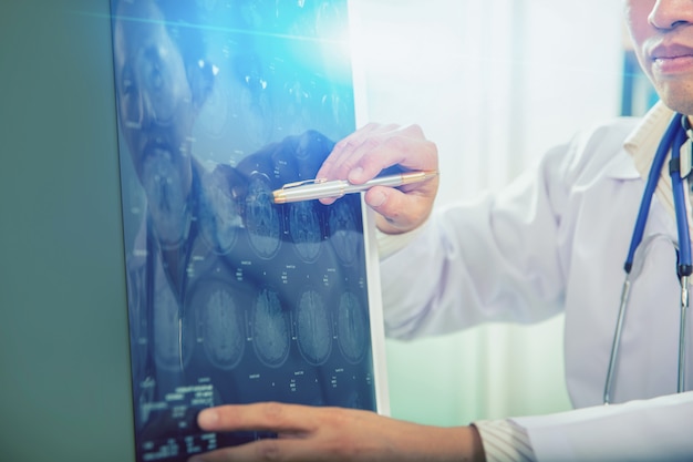 Doctor give advice to patient about MRI (Xray) brain Scans 