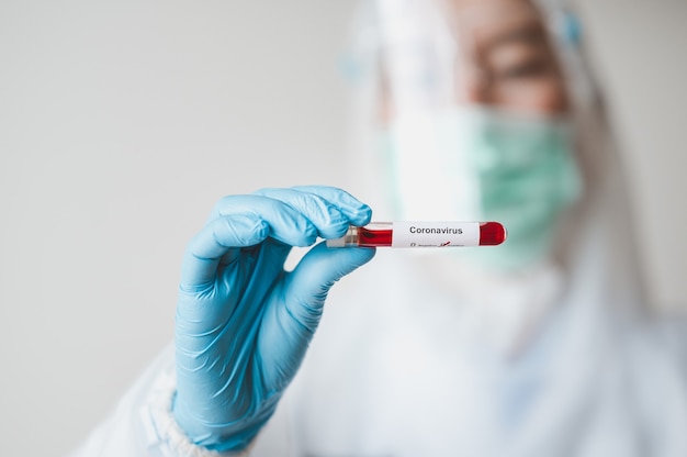 Doctor hand wearing glove holding blood tube test