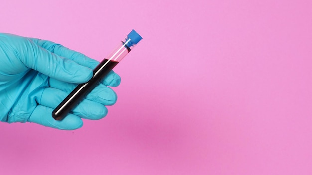 Doctor hands holding blood test tubes on pink background hand wear bule latex glove