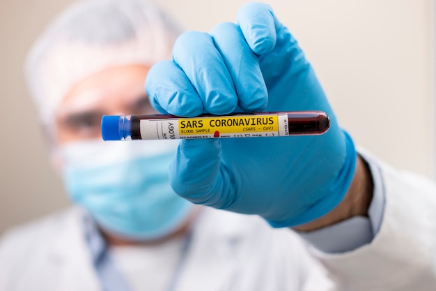 Doctor holding test tube blood sample