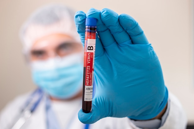 Doctor holding test tube blood sample