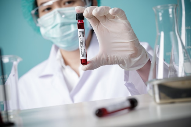 Doctor holding testing patients blood samples for Coronavirus Outbreak (COVID-19) in the laboratory, New coronavirus 2019-nCoV