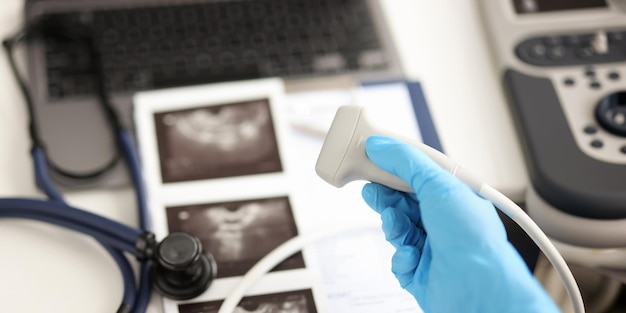 Doctor holding ultrasound probe against background of pictures and medical documents closeup