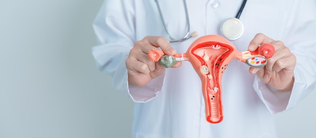 Doctor holding Uterus and Ovaries model Ovarian and Cervical cancer Cervix disorder Endometriosis Hysterectomy Uterine fibroids Reproductive system and Pregnancy concept