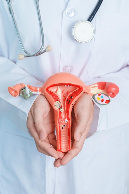 Doctor holding Uterus and Ovaries model Ovarian and Cervical cancer Cervix disorder Endometriosis Hysterectomy Uterine fibroids Reproductive system and Pregnancy concept