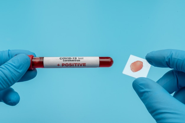 Doctor holds COVID 19 Coronavirus vaccine in his hand, infected blood sample in the sample tube, Vaccine and syringe injection It use for prevention, immunization and treatment from COVID-19