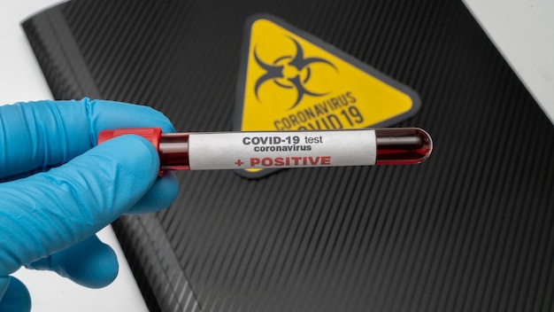 Doctor holds COVID 19 Coronavirus vaccine in his hand, infected blood sample in the sample tube, Vaccine and syringe injection It use for prevention, immunization and treatment from COVID-19