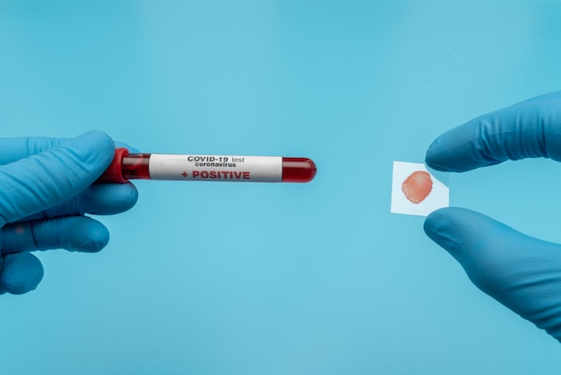 Doctor holds COVID 19 Coronavirus vaccine in his hand, infected blood sample in the sample tube, Vaccine and syringe injection It use for prevention, immunization and treatment from COVID-19